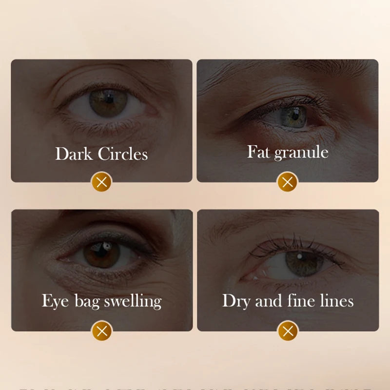 SADOER Eye cream Anti Dark Circles